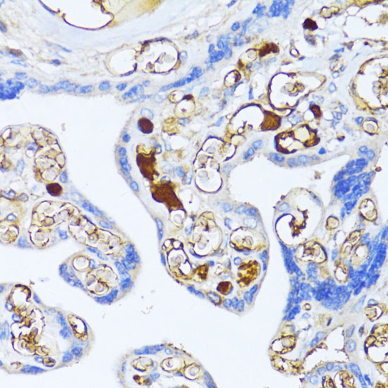 Alpha-2-Macroglobulin (A2M) Rabbit Polyclonal Antibody
