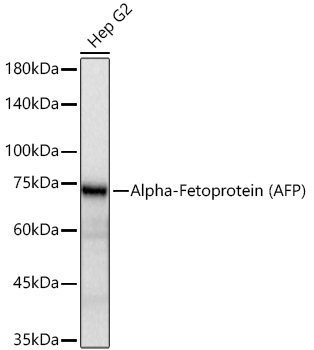 Alpha-Fetoprotein (AFP) Mouse Monoclonal Antibody