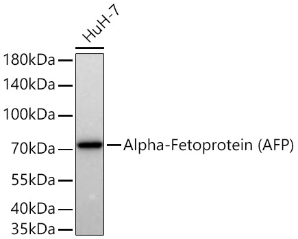Alpha-Fetoprotein (AFP) Mouse Monoclonal Antibody