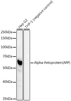 Alpha-Fetoprotein (AFP) Rabbit Monoclonal Antibody