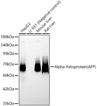 Alpha-Fetoprotein (AFP) Rabbit Polyclonal Antibody