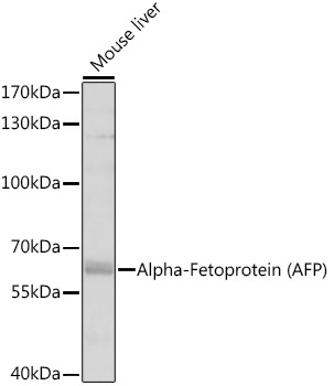 Alpha-Fetoprotein (AFP) Rabbit Polyclonal Antibody