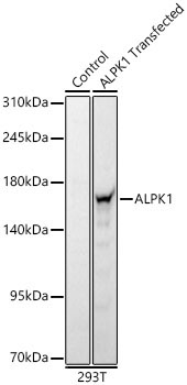 ALPK1 Rabbit Polyclonal Antibody