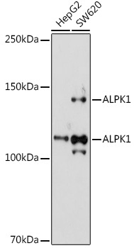 ALPK1 Rabbit Polyclonal Antibody