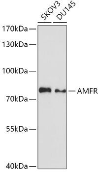 AMFR Rabbit Polyclonal Antibody