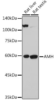 AMH Rabbit Polyclonal Antibody