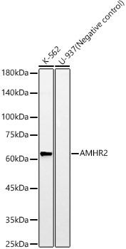 AMHR2 Rabbit Monoclonal Antibody