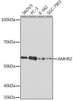 AMHR2 Rabbit Monoclonal Antibody