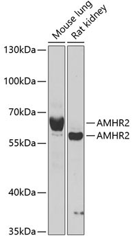 AMHR2 Rabbit Polyclonal Antibody