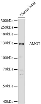 AMOT Rabbit Polyclonal Antibody