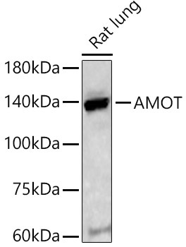 AMOT Rabbit Polyclonal Antibody