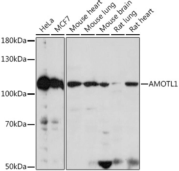 AMOTL1 Rabbit Polyclonal Antibody