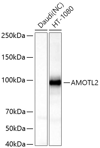 AMOTL2 Rabbit Polyclonal Antibody