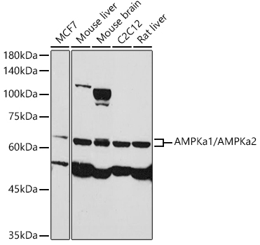 AMPKa1/AMPKa2 Rabbit Polyclonal Antibody
