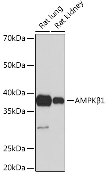 AMPKBeta1 Rabbit Monoclonal Antibody