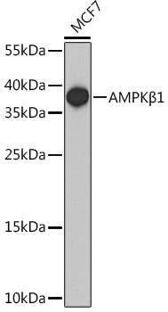AMPKBeta1 Rabbit Polyclonal Antibody