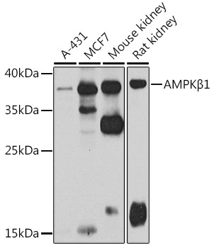 AMPKBeta1 Rabbit Polyclonal Antibody