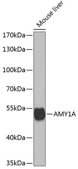 AMY1A Rabbit Polyclonal Antibody