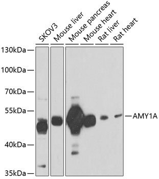 AMY1A Rabbit Polyclonal Antibody