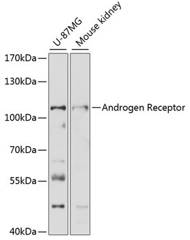 Androgen Receptor Rabbit Polyclonal Antibody