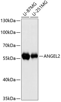 ANGEL2 Rabbit Polyclonal Antibody