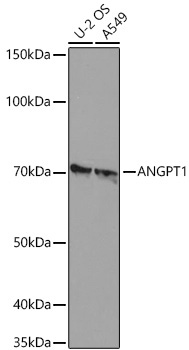 ANGPT1 Rabbit Monoclonal Antibody