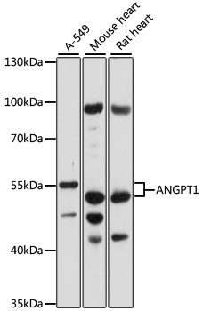 ANGPT1 Rabbit Polyclonal Antibody