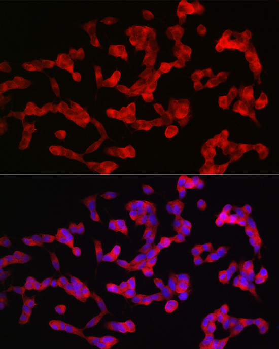 ANK3 Rabbit Polyclonal Antibody