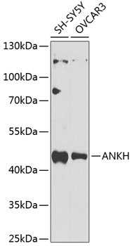 ANKH Rabbit Polyclonal Antibody