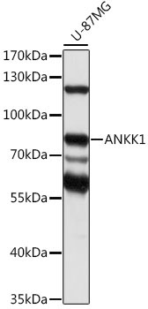 ANKK1 Rabbit Polyclonal Antibody