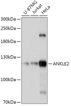 ANKLE2 Rabbit Polyclonal Antibody