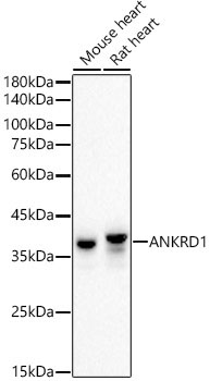 ANKRD1 Rabbit Monoclonal Antibody