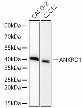 ANKRD1 Rabbit Monoclonal Antibody