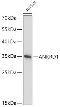 ANKRD1 Rabbit Polyclonal Antibody