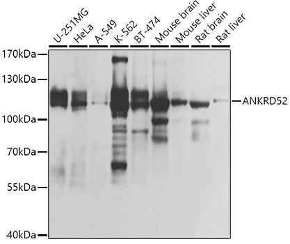 ANKRD52 Rabbit Polyclonal Antibody
