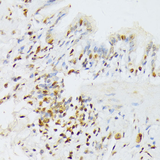 ANKRD52 Rabbit Polyclonal Antibody