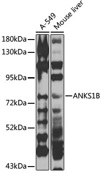 ANKS1B Rabbit Polyclonal Antibody