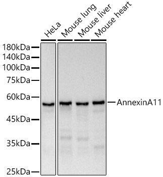 Annexin A11 Rabbit Monoclonal Antibody