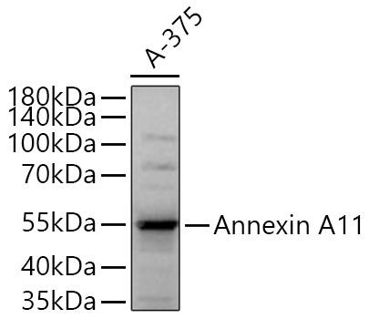 Annexin A11  Rabbit Polyclonal Antibody