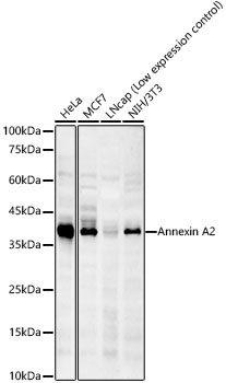 Annexin A2 Rabbit Monoclonal Antibody