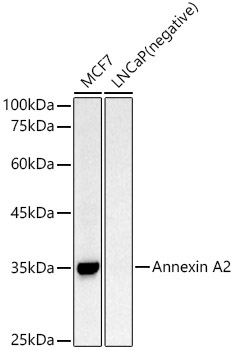 Annexin A2 Rabbit Polyclonal Antibody