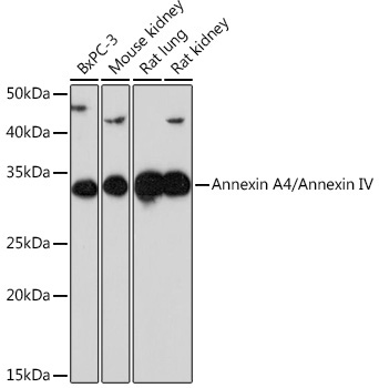 Annexin A4/Annexin IV Rabbit Monoclonal Antibody