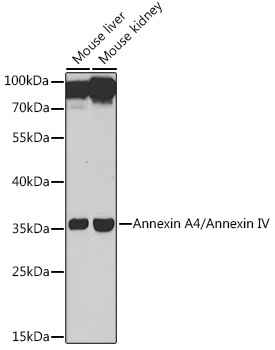 Annexin A4/Annexin IV Rabbit Polyclonal Antibody