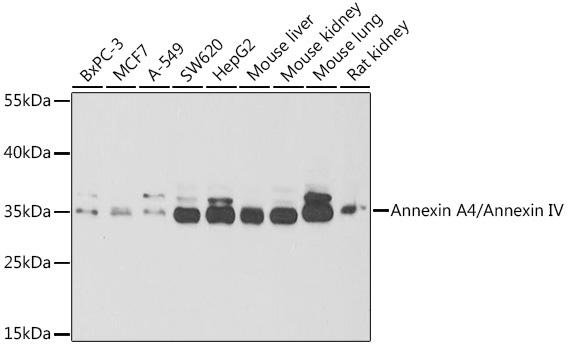 Annexin A4/Annexin IV Rabbit Polyclonal Antibody