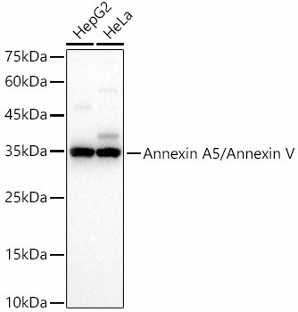 Annexin A5/Annexin V Rabbit Polyclonal Antibody