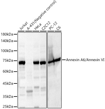 Annexin A6/Annexin VI Rabbit Polyclonal Antibody
