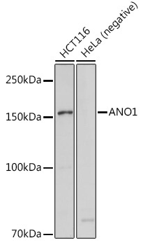 ANO1 Rabbit Polyclonal Antibody