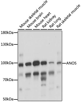 ANO5 Rabbit Polyclonal Antibody