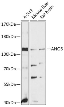 ANO6 Rabbit Polyclonal Antibody