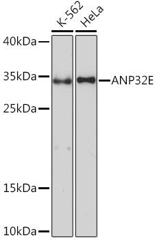 ANP32E Rabbit Polyclonal Antibody